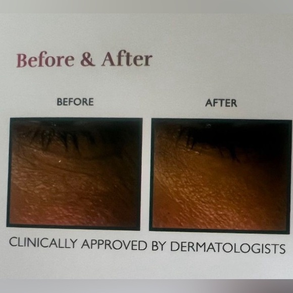 Silk’n FaceTite 3-in-1 anti-aging: RF, LED Light,&Infrared heat Shield - Picture 3 of 7